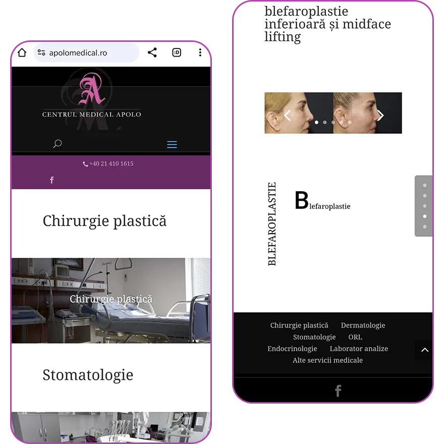 Vechiul website Centrul Medical Apolo pe telefon, captura 1